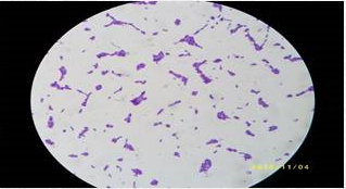 约氏乳杆菌菌粉生产项目